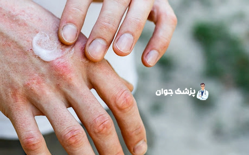 روتین مراقبت پوستی مناسب برای جلوگیری از ترک پوست